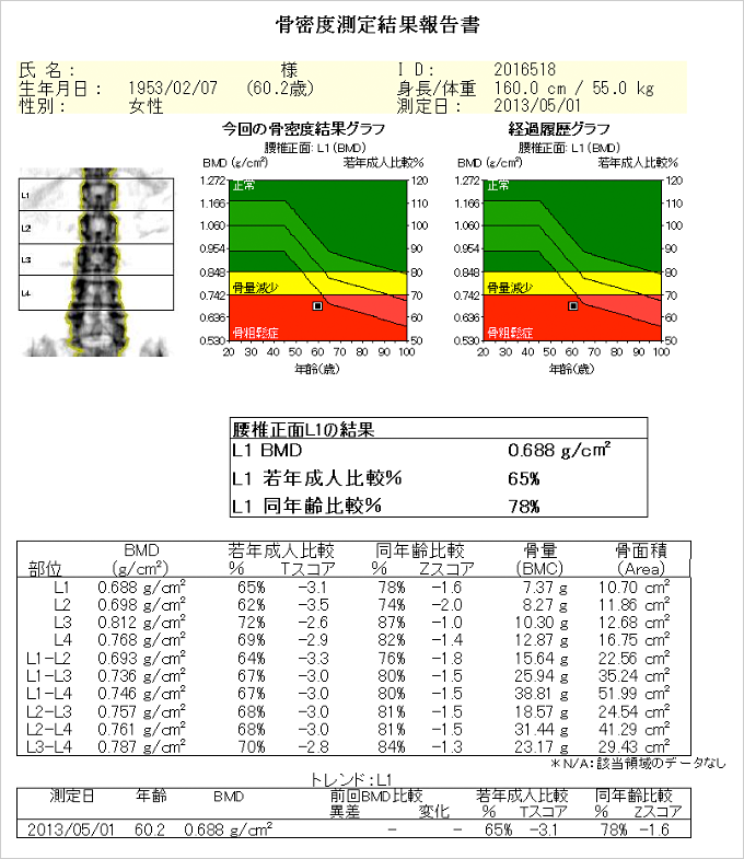 骨密度測定結果報告書
