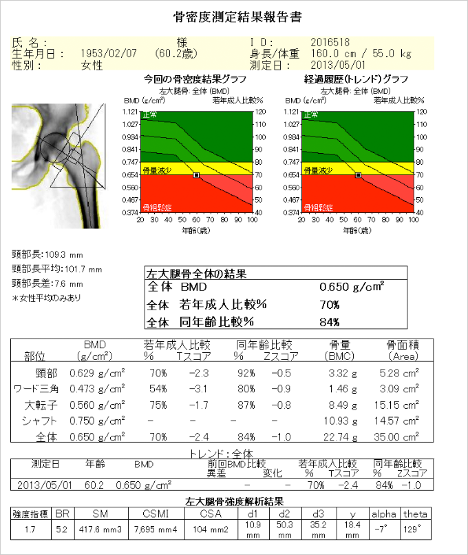 骨密度測定結果報告書
